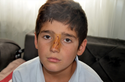 Muş&#039;ta 2 kardeş sahipsiz köpeklerin saldırısı sonucu yaralandı