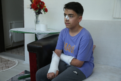 Kars&#039;ta sahipsiz köpeğin saldırdığı çocuk yaralandı