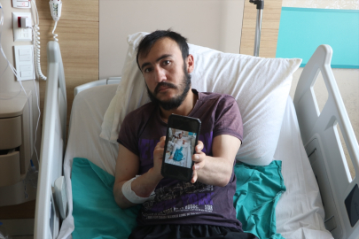 Yıldırım isabet eden çobanın bacakları cilt nakli ve cerrahi müdahaleyle kurtarıldı