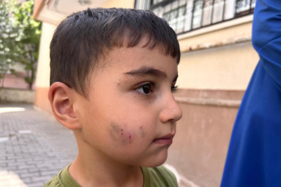 Sincan’ı lağım fareleri bastı