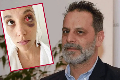 Tepkiler dinmedi, Ozan Güven müzikal kadrosundan çıkarıldı!