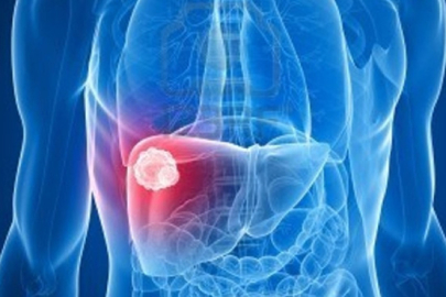 Karaciğer sağlığınızı yüzünüz ele veriyor! İşte dikkat etmeniz gereken işaretler