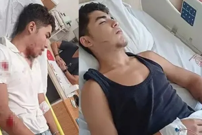 Konsere gitti, komalık oldu: 14 yaşındaki Kenan Efe’yi döverek hastanelik  ettiler!