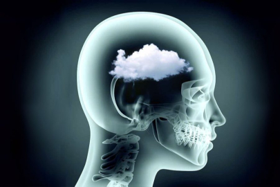 Beyin sisi nedir, nasıl giderilebilir?