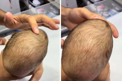 Yeni doğan bebeğin bıngıldağına basan doktorun karşılaştığı görüntü şaşkınlık yarattı!