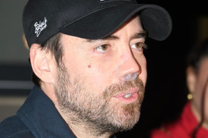 Murat Dalkılıç 12’nci burun ameliyatını ve zorlu sürecini anlattı