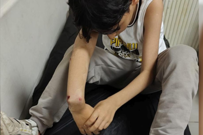 10 yaşındaki çocuğun kolunu kıran uzman çavuş için iddianame