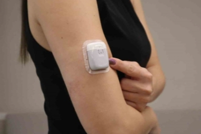 Diyabette yapay pankreas dönemi başlıyor