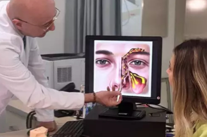 Balon yöntemi sinüzit ameliyatlarında riski en aza indiriyor