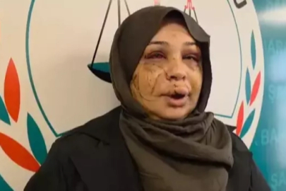 Eşine şiddet uygulayan Cumhurbaşkanı Koruma Dairesi personeli hakkında yeni karar!