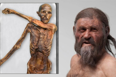 Kanserle ilişkilendirilen HPV binlerce yıl öncesine uzanıyor