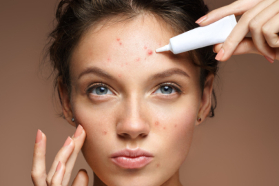 Cilt sağlığını destekleyen beslenme önerileri