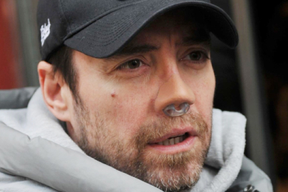 Murat Dalkılıç: Ameliyat olacağım