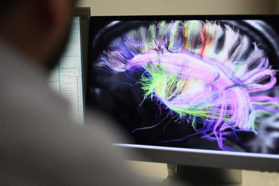 Bilimden şaşırtan sonuç: Beyindeki bir ritim insanı daha cömert yapabiliyor