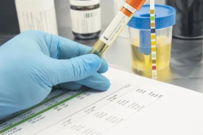 İşe alımlarda yeni dönem: Uyuşturucu testi şartı yaygınlaşıyor