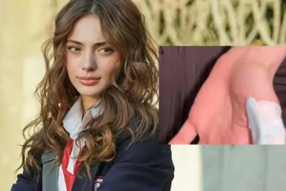 Sette korkutan kaza: Rabia Soytürk’ün parmağı kopma noktasına geldi