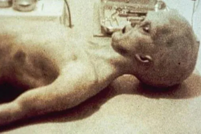 Dünyayı yıllarca inandıran görüntü çöktü: “Uzaylı otopsisi” itirafı geldi