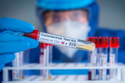 COVID’in gizli nedeni ortaya çıktı: Yaşlanan akciğerler ölümcül süreci tetikliyor