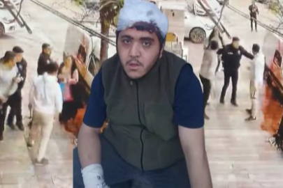 Sultangazi’de engelli genç ve annesi sokak ortasında darbedildi