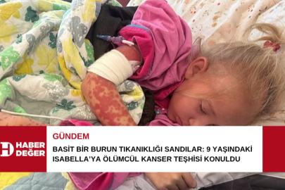 Basit bir burun tıkanıklığı sandılar: 9 yaşındaki Isabella’ya ölümcül kanser teşhisi konuldu